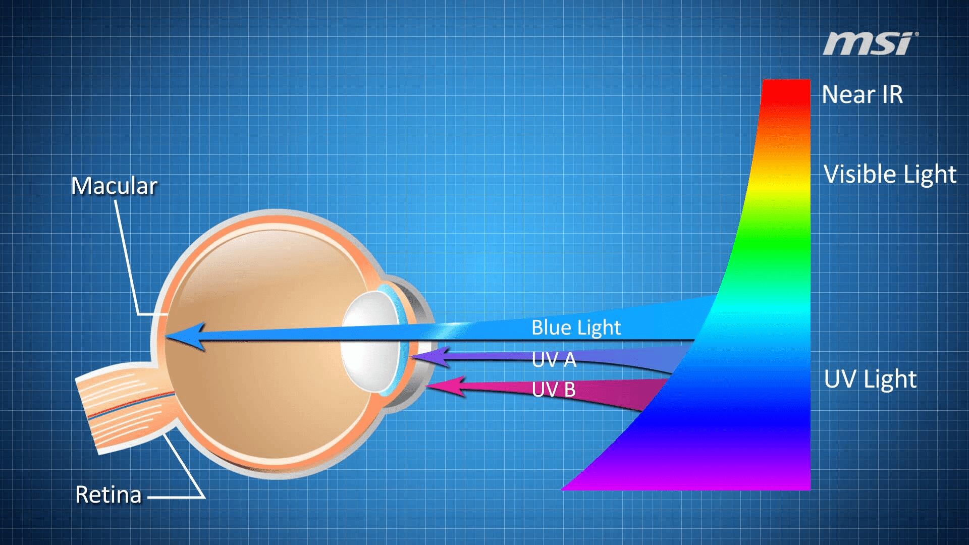 Cấu trúc của mắt người không bảo vệ được mắt khỏi ánh sáng xanh