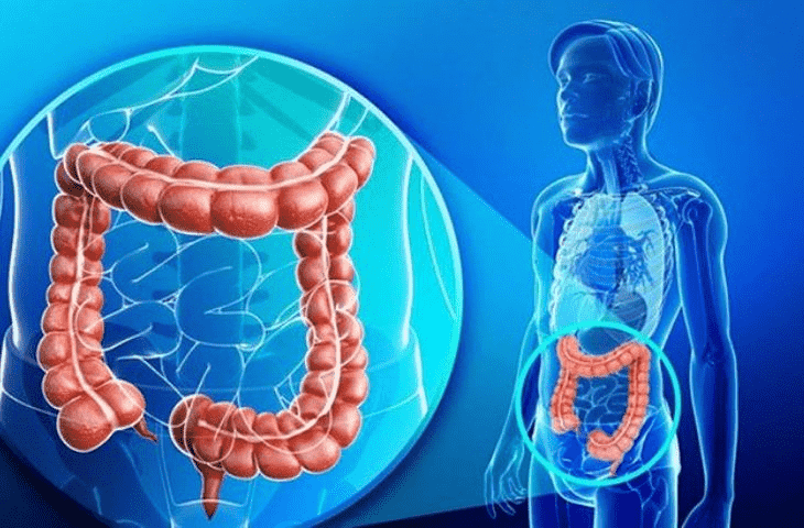 Lợi khuẩn Probiotic giúp giảm hội chứng ruột kích