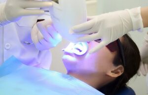 Tia laser giúp làm trắng răng