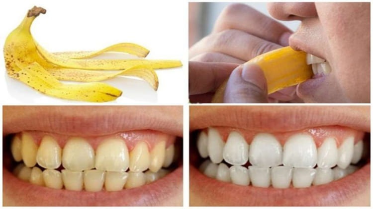 Vỏ chuối giúp làm trắng răng hiệu quả